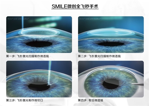 全飛秒or半飛秒你懂嗎？半飛秒冒充全飛秒，聽聽專家怎么說